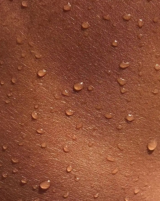 Irritation
